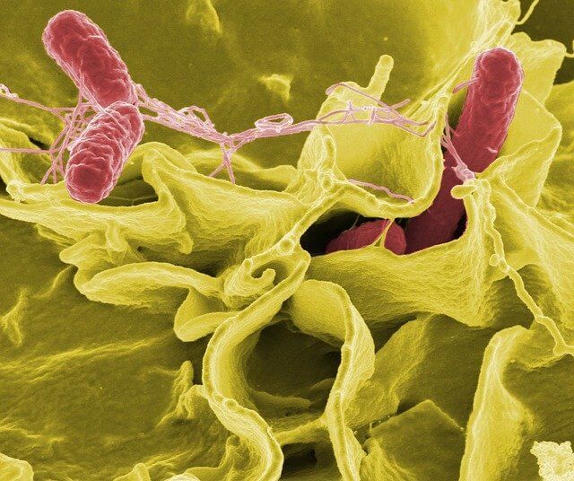 Pathogens Salmonella Infection Disease Detected Under a Microscope